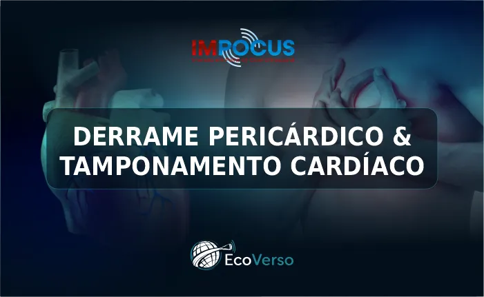 DERRAME PERICÁRDICO E TAMPONAMENTO CARDÍACO