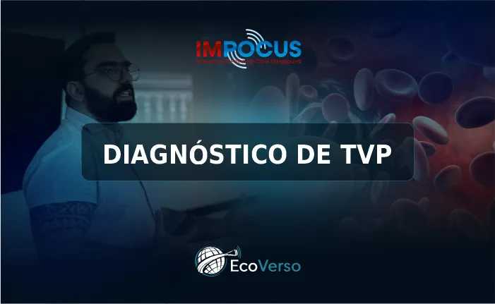DIAGNÓSTICO DE TVP
