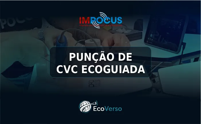 PUNÇÃO DE CVC ECOGUIDADA