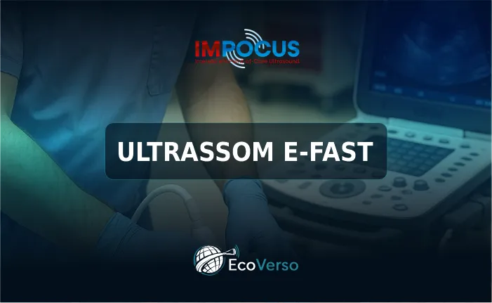 ULTRASSOM E-FAST